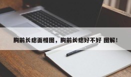 胸前长痣面相图，胸前长痣好不好 图解！