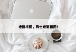 痣面相图，男士痣面相图！