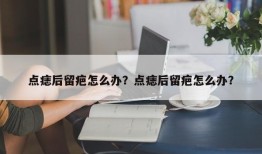 点痣后留疤怎么办？点痣后留疤怎么办？