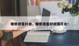 哪些痣是好痣，哪些痣是好痣图片女！